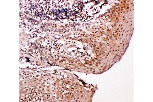 Anti-Caspase-14 antibody, IHC(P) IHC(P): Human Tonsil Tissue (CASP14 抗体  (C-Term))