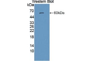 Detection of Recombinant PSAP, Human using Polyclonal Antibody to Prosaposin (PSAP) (Prosaposin 抗体  (AA 17-524))