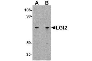 Image no. 1 for anti-Leucine-Rich Repeat LGI Family, Member 2 (LGI2) (N-Term) antibody (ABIN1494389) (LGI2 抗体  (N-Term))