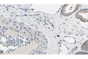 ABIN6269106 at 1/100 staining Human prostate tissue by IHC-P. (EIF4E 抗体  (C-Term))