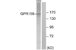 Immunohistochemistry analysis of paraffin-embedded human brain tissue using GPR158 antibody. (GPR158 抗体  (Internal Region))
