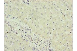 Immunohistochemistry (IHC) image for anti-Ring Finger Protein 5, E3 Ubiquitin Protein Ligase (RNF5) (AA 1-120) antibody (ABIN7151202)