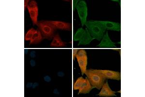 ABIN6256279 and ABIN6267329 staining  cells(H2O2 treatment) by IF/ICC. (beta 2 Adrenergic Receptor 抗体  (pSer346))