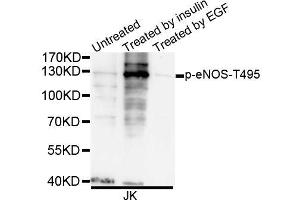 Western blot analysis of extracts of JK cells, using Phospho-eNOS-T495 antibody (ABIN5995598). (ENOS 抗体  (pTyr495))