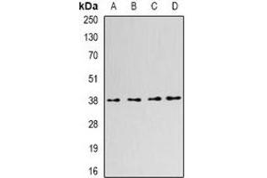 Western blot analysis of SLM-1 expression in Hela (A), K562 (B), MCF7 (C), NIH3T3 (D) whole cell lysates. (KHDRBS2 抗体)