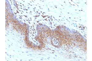 Immunohistochemistry (IHC) image for anti-beta-2-Microglobulin (B2M) antibody (ABIN6940416)