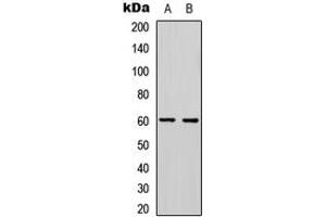 Western blot analysis of PDCD4 (pS457) expression in HeLa (A), Jurkat (B) whole cell lysates. (PDCD4 抗体  (C-Term, pSer457))