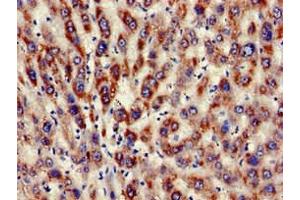 Immunohistochemistry of paraffin-embedded human liver tissue using ABIN7157524 at dilution of 1:100 (KIR3DL1 抗体  (AA 81-336))