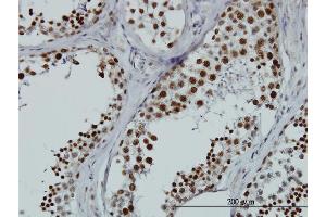 Immunoperoxidase of monoclonal antibody to HNRNPG-T on formalin-fixed paraffin-embedded human testis. (RBMXL2 抗体  (AA 1-90))