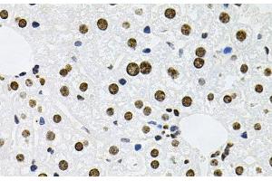 Immunohistochemistry of paraffin-embedded Mouse liver using MCL1 Polyclonal Antibody at dilution of 1:100 (40x lens). (MCL-1 抗体)