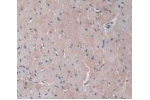 DAB staining on IHC-P; Samples: Rat Heart Tissue. (ORM1 抗体  (AA 19-186))