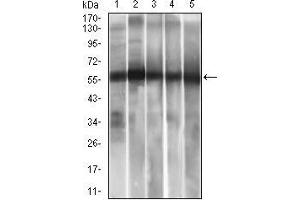 Western Blotting (WB) image for anti-Aldehyde Dehydrogenase 2 Family (Mitochondrial) (ALDH2) (AA 317-517) antibody (ABIN1724795)