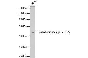 Western blot analysis of extracts of HeLa cells, using Galactosidase alpha (Galactosidase alpha (GLA)) antibody  at 1:1000 dilution. (GLA 抗体  (AA 150-429))