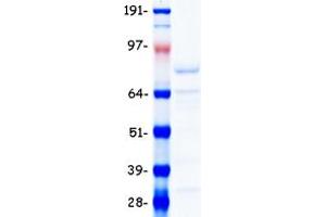 Validation with Western Blot