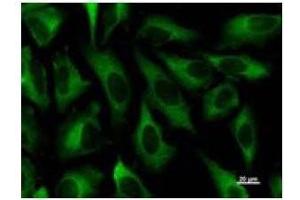 Immunostaining analysis in HeLa cells. (ZW10 抗体)