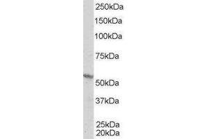 ABIN2559796 staining (1µg/ml) of A431 lysate (RIPA buffer, 35µg total protein per lane). (Retinoid X Receptor beta 抗体  (Internal Region))