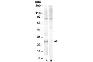 Western blot testing of human heart lysate with APOBEC2 antibody at 1ug/ml with [B] and without [A] blocking peptide. (APOBEC2 抗体)