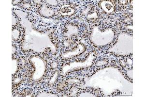IHC analysis of RCC1 using anti-RCC1 antibody (ABIN7600022). (RCC1 抗体  (AA 14-421))