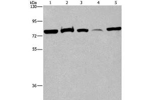 Western Blot analysis of 293T cell, Human fetal brain tissue and K562 cell, Human fetal liver tissue and Hela cell using ACVR2A Polyclonal Antibody at dilution of 1:400 (ACVR2A 抗体)