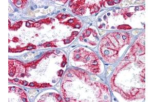 Immunohistochemical analysis of paraffin-embedded human Kidney tissues using CK8 mouse mAb (KRT8 抗体)