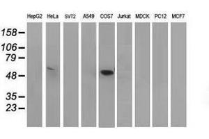 Image no. 2 for anti-Tumor Protein P53 (TP53) antibody (ABIN1499976) (p53 抗体)