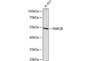 Western blot analysis of extracts of A-431 cells, using PI4K2B antibody (ABIN7269285) at 1:1000 dilution. (PI4K2B 抗体  (AA 1-120))