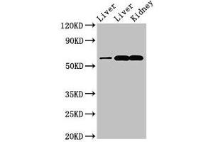 Western Blot Positive WB detected in: Rat liver tissue, Mouse liver tissue, Mouse kidney tissue All lanes: ZNF695 antibody at 3. (ZNF695 抗体  (AA 1-88))