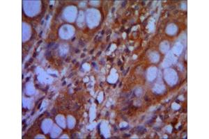 Immunohistochemistry (IHC) image for anti-Chromodomain Helicase DNA Binding Protein 3 (CHD3) antibody (ABIN2983311) (CHD3 抗体)