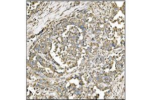 IHC analysis of HCCS using anti-HCCS antibody (ABIN7602424).