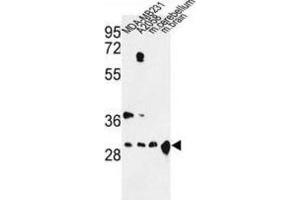 Western Blotting (WB) image for anti-14-3-3 zeta (YWHAZ) antibody (ABIN3003721) (14-3-3 zeta 抗体)
