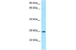 WB Suggested Anti-TNIP3 Antibody Titration: 1. (TNIP3 抗体  (N-Term))