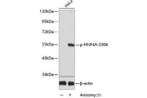 Western blot analysis of extracts from HeLa cells using Phospho-HNF4A(S304) Polyclonal Antibody. (HNF4A 抗体  (pSer304))