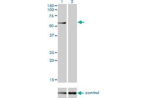 Western blot analysis of CESK1 over-expressed 293 cell line, cotransfected with CESK1 Validated Chimera RNAi (Lane 2) or non-transfected control (Lane 1). (CCT8L2 抗体  (AA 1-557))