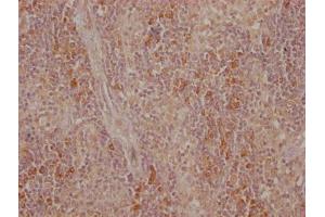 IHC image of ABIN7149430 diluted at 1:500 and staining in paraffin-embedded human tonsil tissue performed on a Leica BondTM system. (CTLA4 抗体  (AA 37-162))