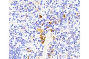 IHC analysis of TRAP/CD40L/Cd40lg using anti-TRAP/CD40L/Cd40lg antibody (ABIN7599747). (CD40 Ligand 抗体  (AA 112-260))