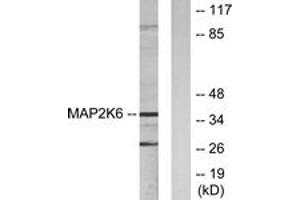 Western Blotting (WB) image for anti-Mitogen-Activated Protein Kinase Kinase 6 (MAP2K6) (AA 1-50) antibody (ABIN2889508) (MAP2K6 抗体  (AA 1-50))