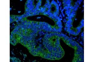 IF analysis of Cytokeratin 18 using anti-Cytokeratin 18 antibody (ABIN7600573).