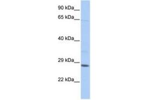 Image no. 1 for anti-TGFB-Induced Factor Homeobox 2-Like, X-Linked (TGIF2LX) (C-Term) antibody (ABIN6742653) (TGIF2LX 抗体  (C-Term))