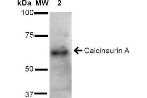 Western blot analysis of Rat Brain cell lysates showing detection of ~61 kDa Calcineurin A protein using Rabbit Anti-Calcineurin A Polyclonal Antibody . (Calcineurin A 抗体  (AA 264-283) (FITC))
