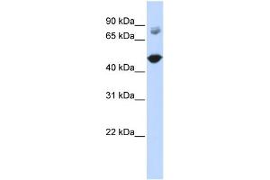 WB Suggested Anti-TBC1D16 Antibody Titration:  0. (TBC1D16 抗体  (Middle Region))