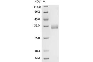CD52 (CD52) (AA 25-36) protein (BSA,His-Avi Tag)