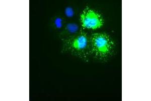 Image no. 1 for anti-Keratin 18 (KRT18) (AA 69-372) antibody (ABIN1491638) (Cytokeratin 18 抗体  (AA 69-372))