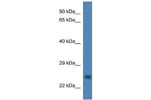 WB Suggested Anti-CCS Antibody Titration: 1. (Superoxide dismutase copper chaperone 抗体  (Middle Region))