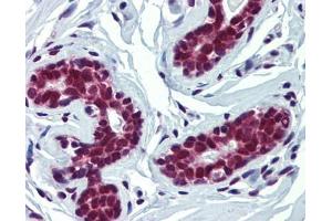 FUBP3 antibody was used for immunohistochemistry at a concentration of 4-8 ug/ml. (FUBP3 抗体  (Middle Region))