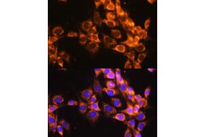 Immunofluorescence analysis of NIH-3T3 cells using  antibody  at dilution of 1:100. (ACAT1 抗体)