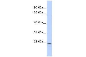 WB Suggested Anti-SCML1 Antibody Titration:  0. (SCML1 抗体  (N-Term))