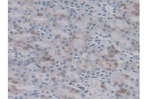 DAB staining on IHC-P;;Samples: Rat Kidney Tissue (HSPB6 抗体  (AA 1-162))
