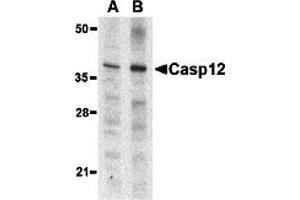 Western Blotting (WB) image for anti-Caspase 12 (Gene/pseudogene) (CASP12) (Small Isoform) antibody (ABIN1031700) (Caspase 12 抗体  (Small Isoform))