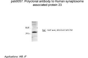 Image no. 2 for anti-Synaptosomal-Associated Protein, 23kDa (SNAP23) antibody (ABIN347011) (SNAP23 抗体)
