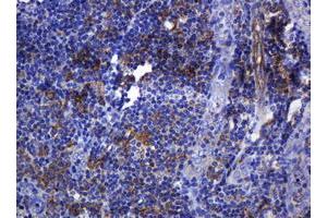 Immunohistochemistry (IHC) image for anti-Sterol O-Acyltransferase 2 (SOAT2) (AA 1-120) antibody (ABIN1490565) (SOAT2 抗体  (AA 1-120))